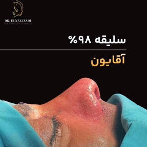1_rhinoplasty-1