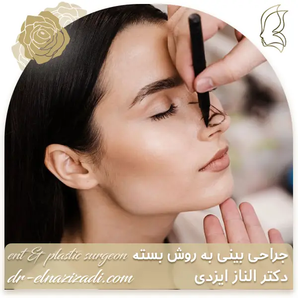 جراحی بینی به روش بسته
