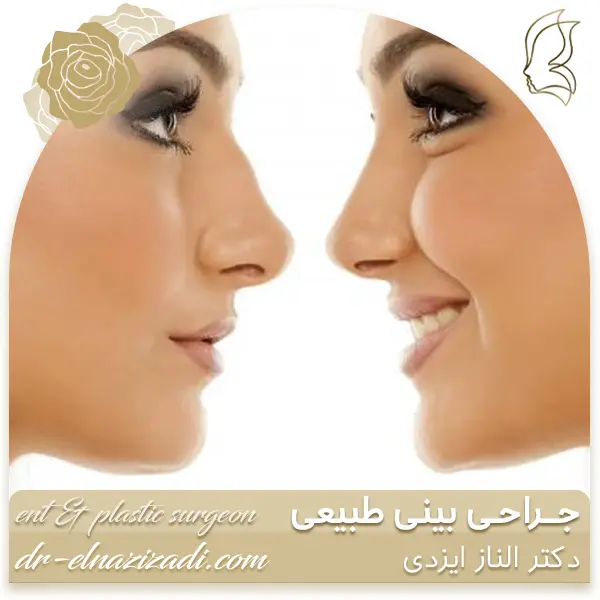 جراحی بینی طبیعی