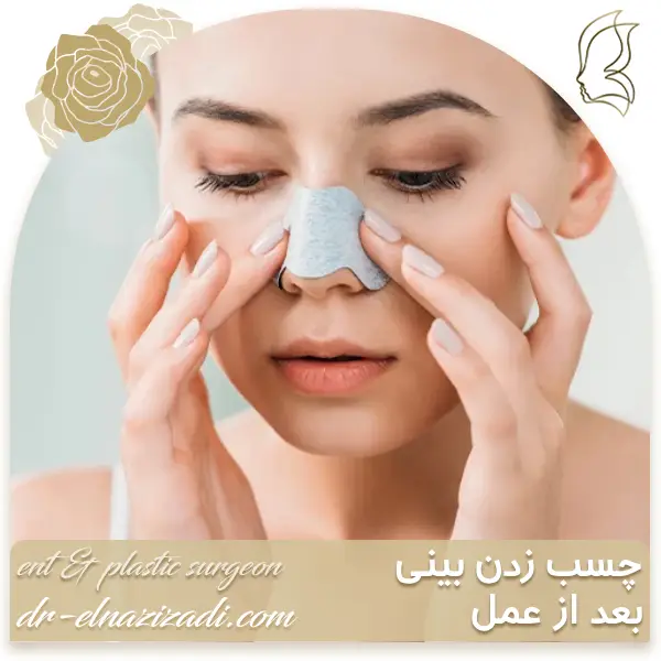 چسب زدن بینی بعد از عمل