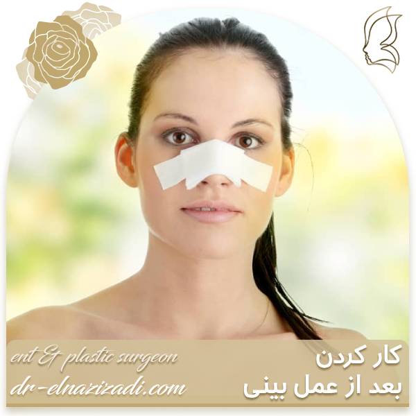 کار کردن بعد از عمل بینی