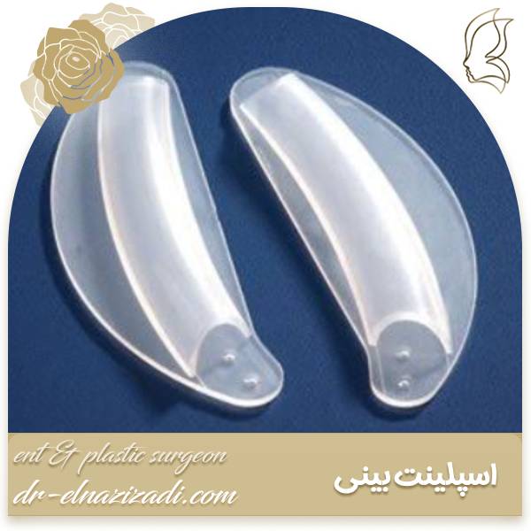 اسپلینت بینی