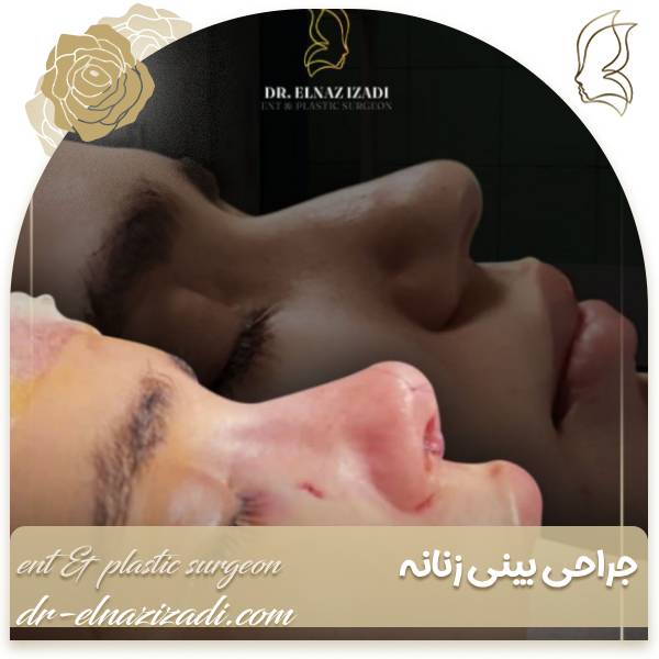 جراحی بینی در زنان