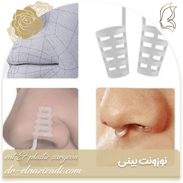 نوزونت بینی